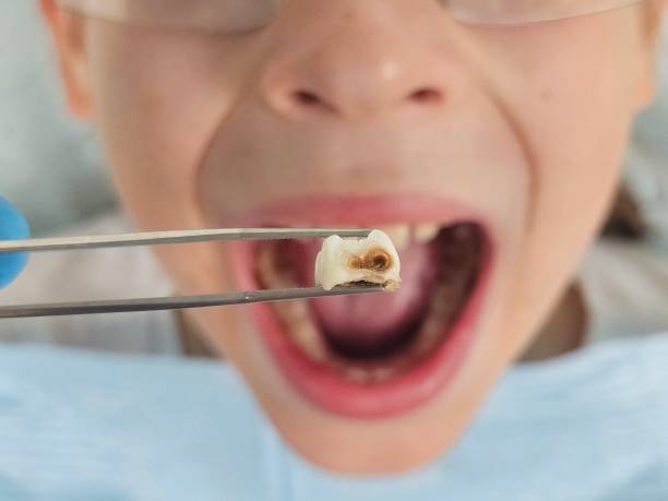 Best Orthodontic Emergency Dentist in Ecru, MS