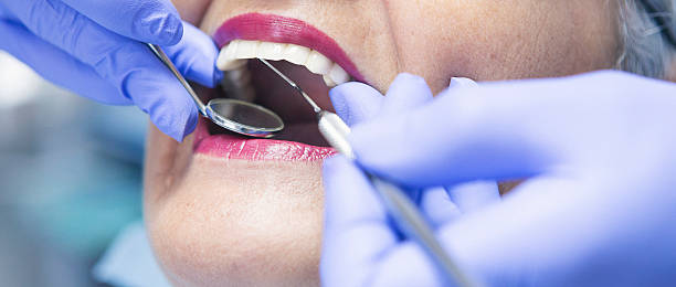 Best Emergency Root Canal Treatment in Ecru, MS